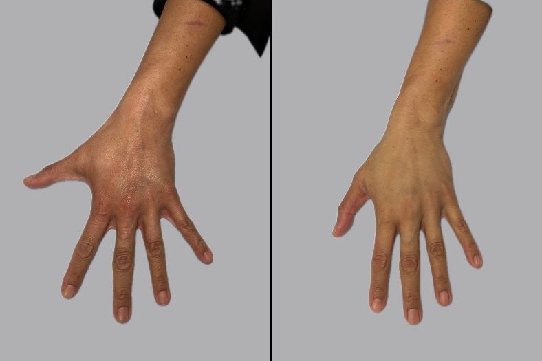 A before and after photo of a person's hands