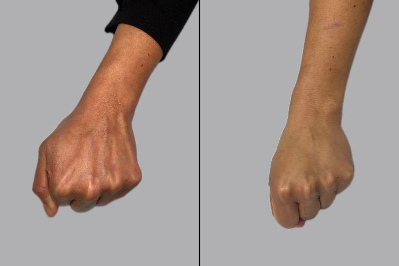 A before and after picture of a person's hands.