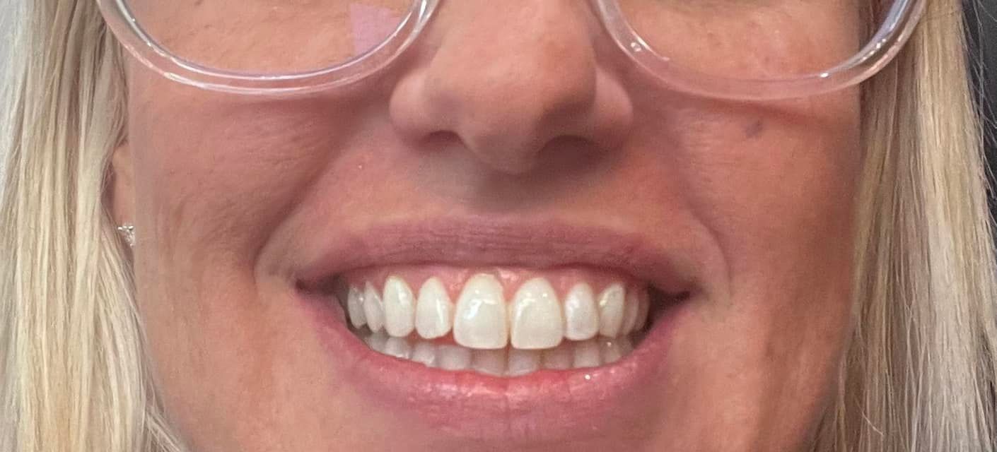 A smiling person with glasses, showing bright white teeth.