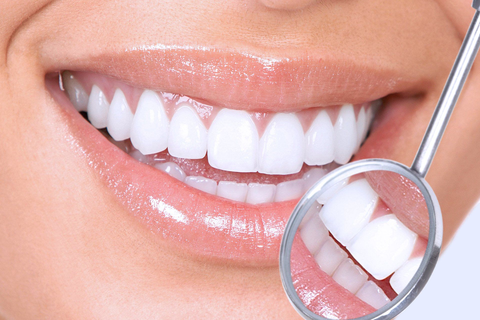 White teeth