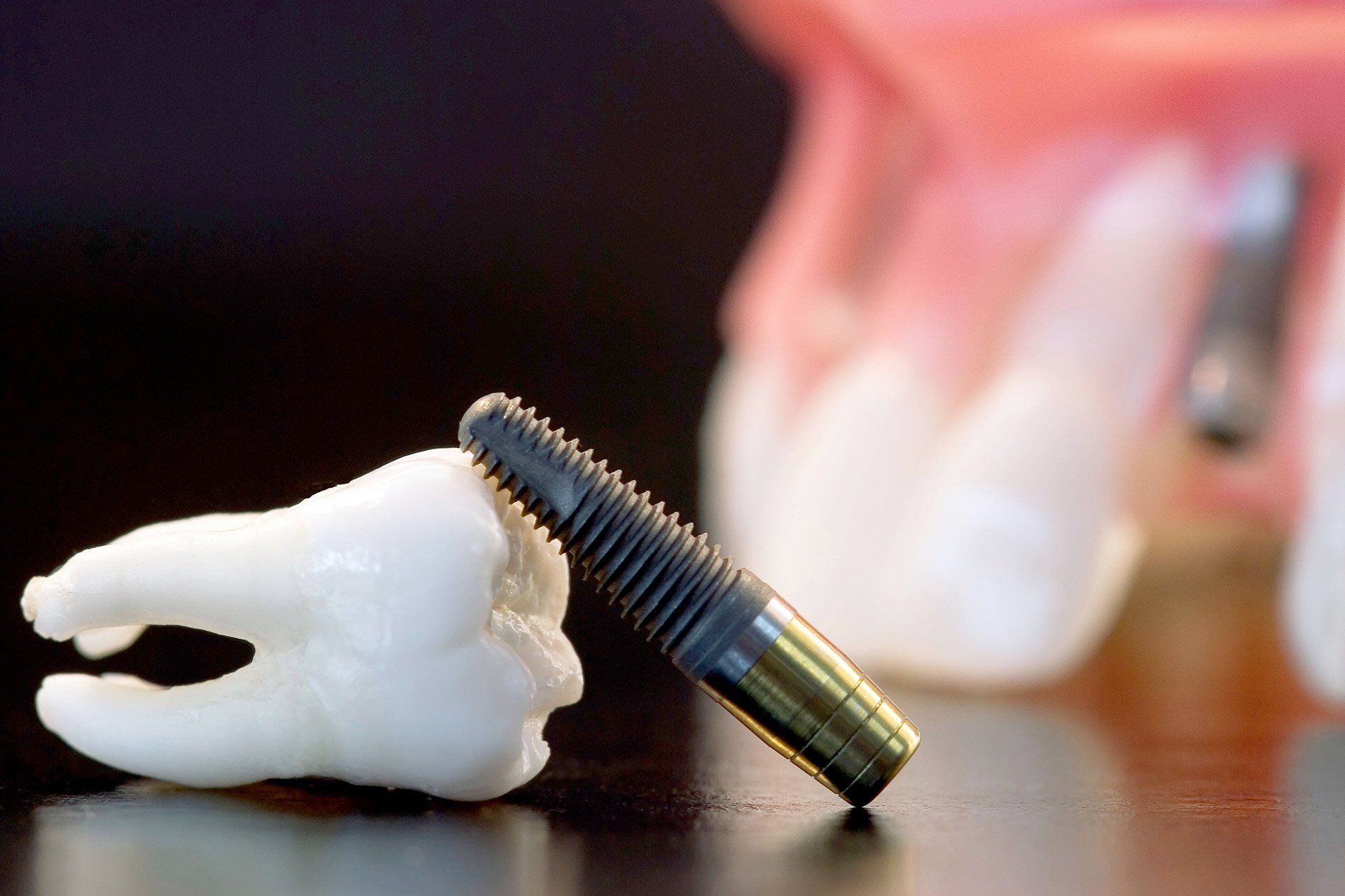 Dental implant