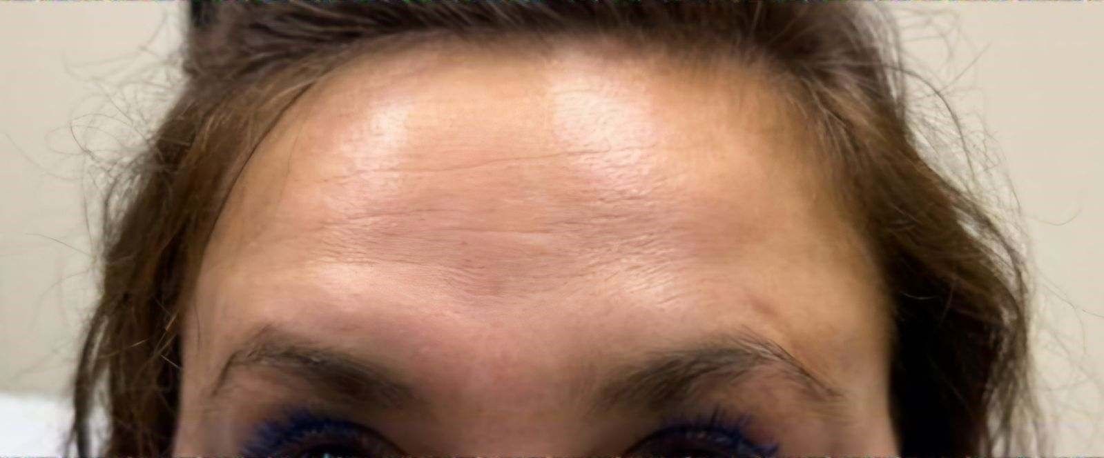 A close-up of a woman's forehead and eyebrows.
