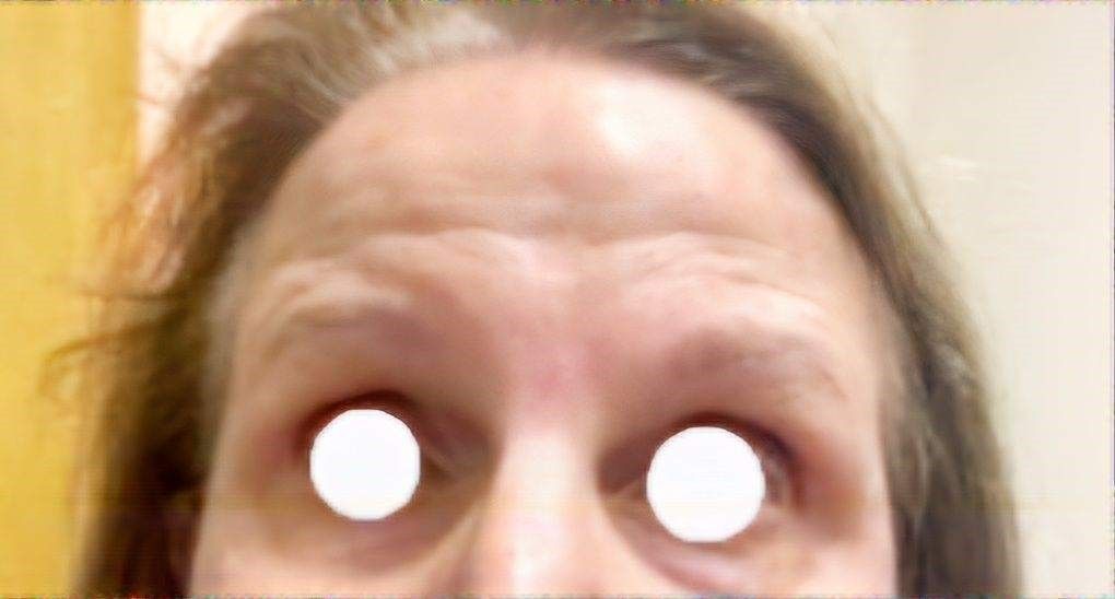 A close-up of a woman's face with white eyes