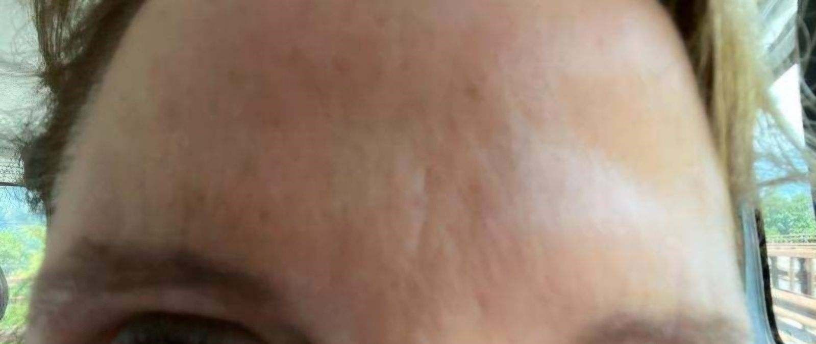 A close-up of a woman's forehead and eyebrows.