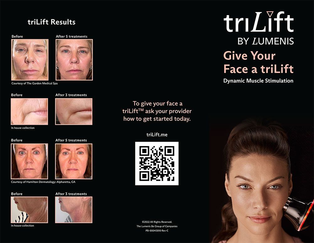 triLift by Lumens - triLift results