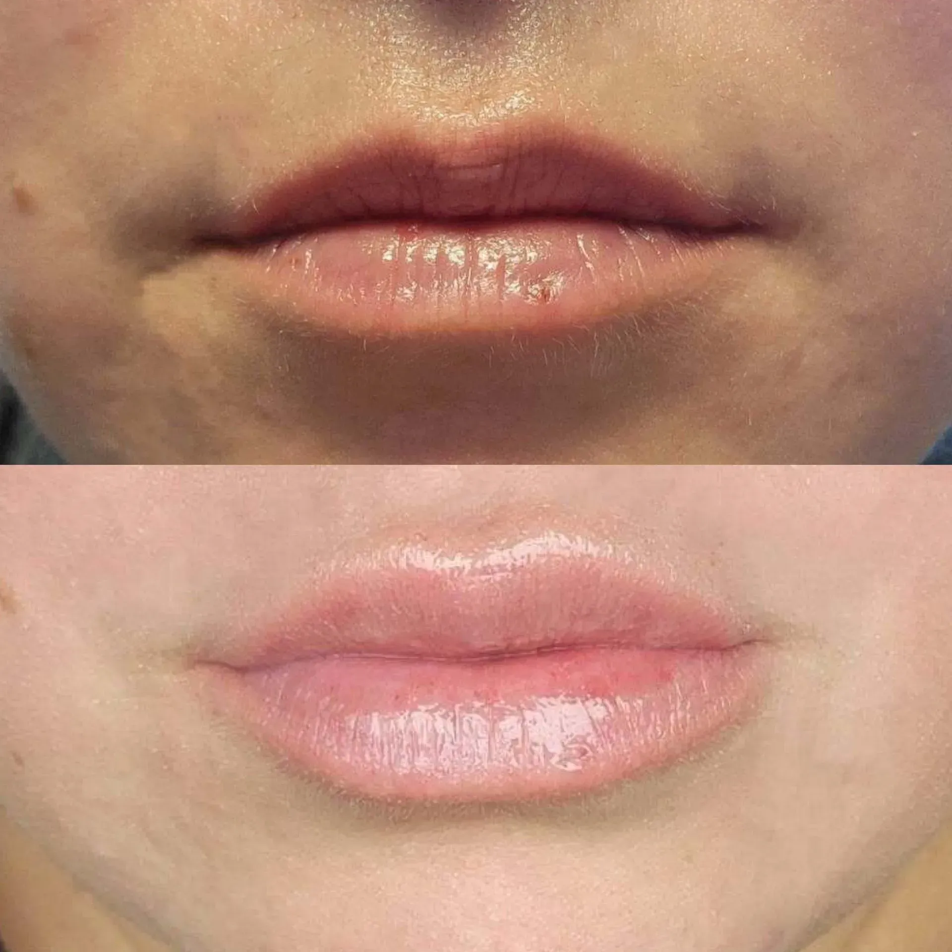 Top: thin lips. Bottom: fuller lips, possibly after a lip filler treatment.