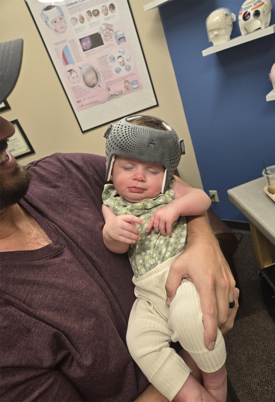 A man is holding a baby wearing a helmet molding therapy