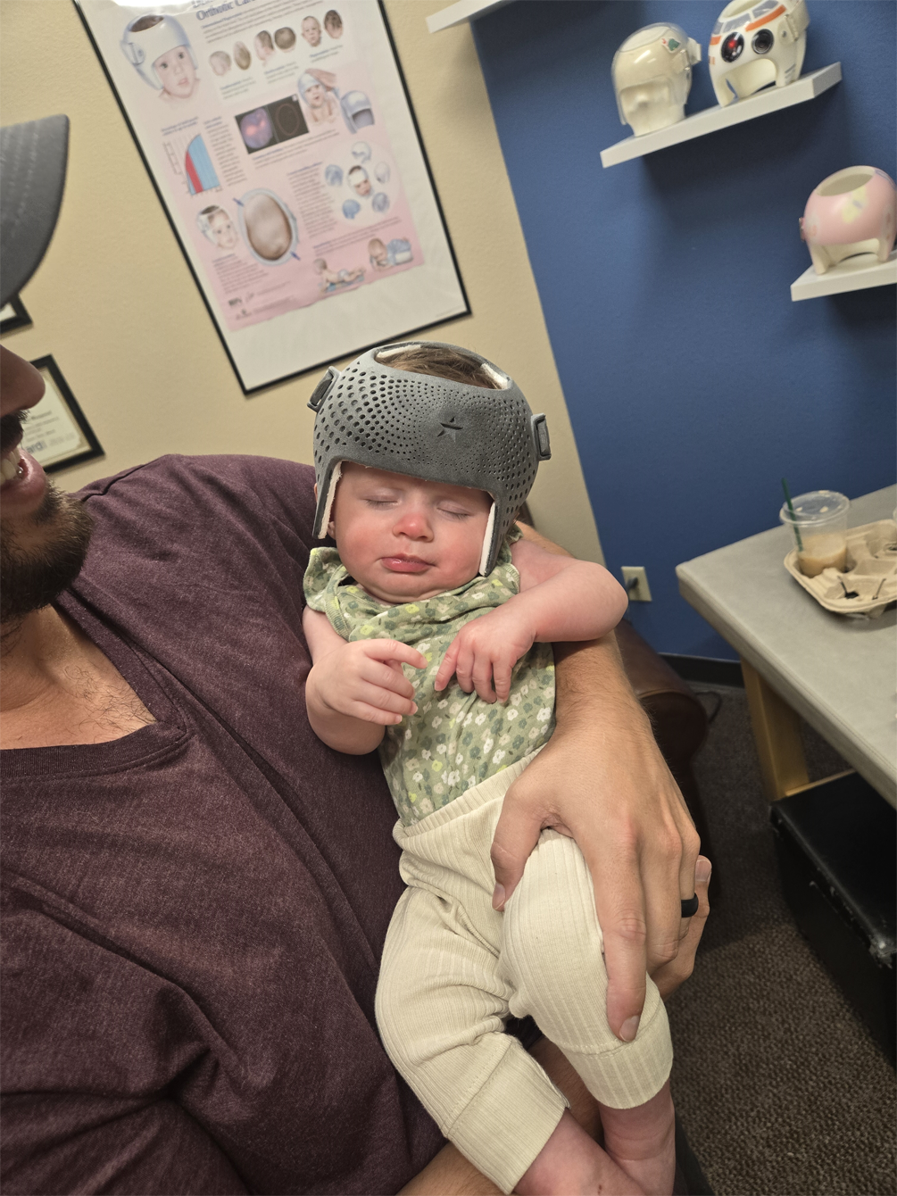 A man is holding a baby wearing a helmet molding therapy
