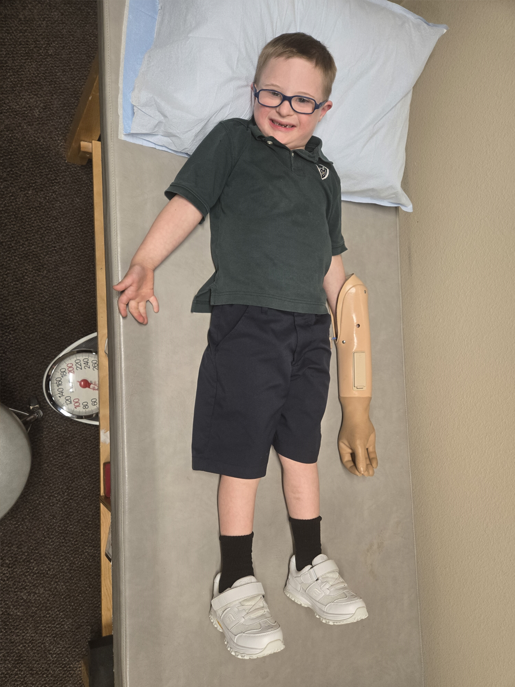 A young boy with a prosthetic arm is laying on a bed