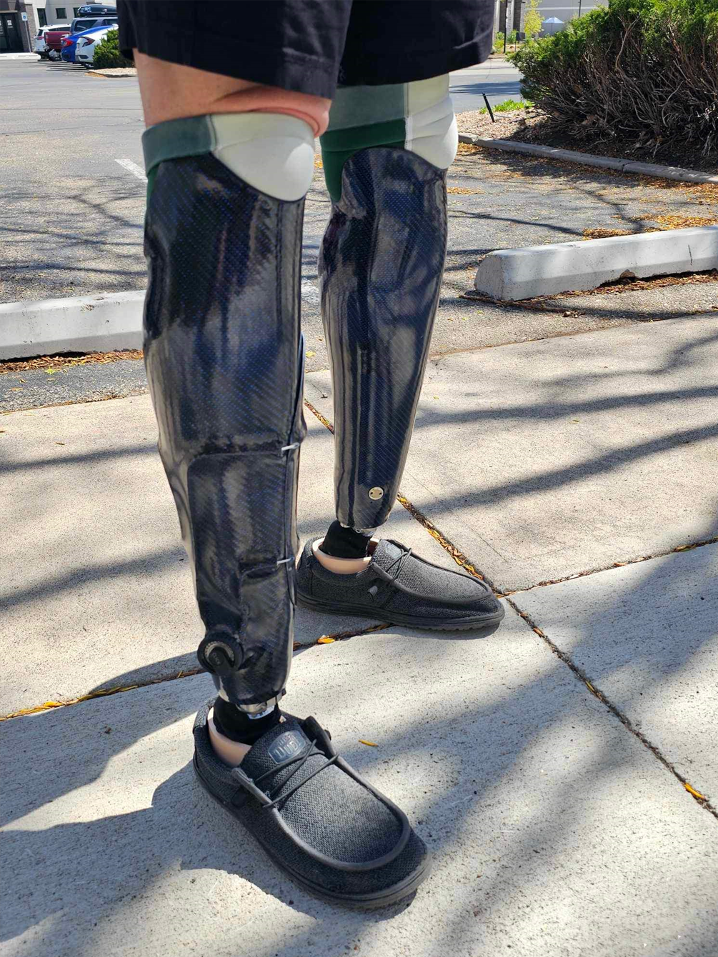 A person with a prosthetic leg is standing on a sidewalk.