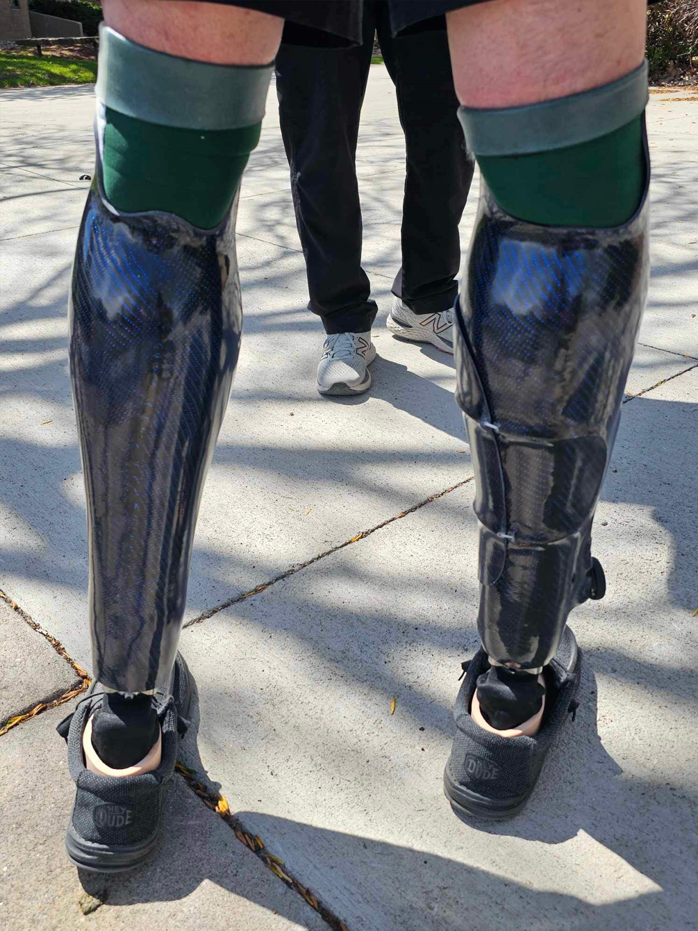 A person with a prosthetic leg is standing on a sidewalk
