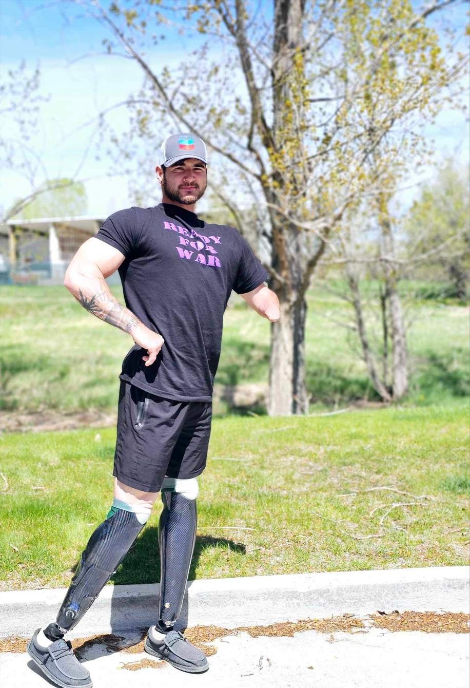 A man with a prosthetic leg is standing on a sidewalk.
