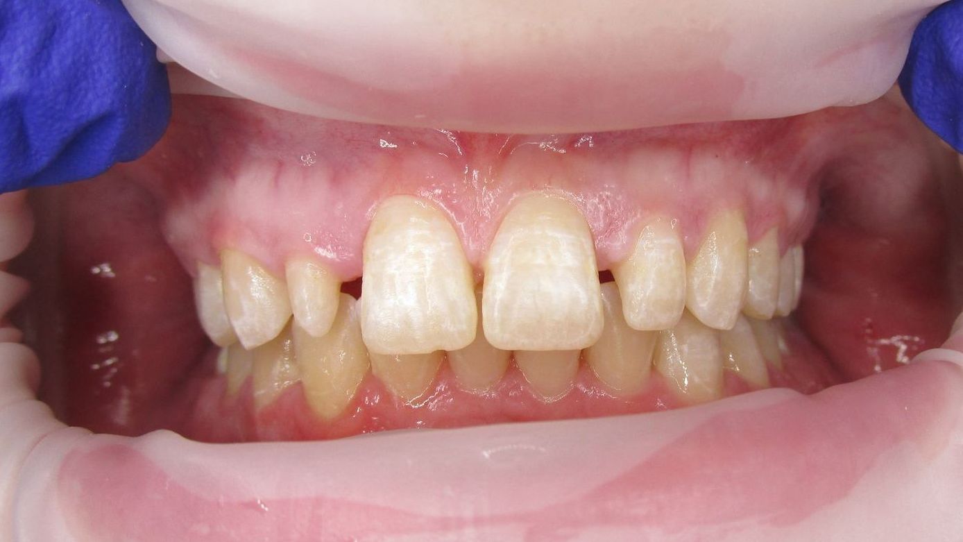 Mouth with visible teeth; two front teeth are larger, with a gap between them.