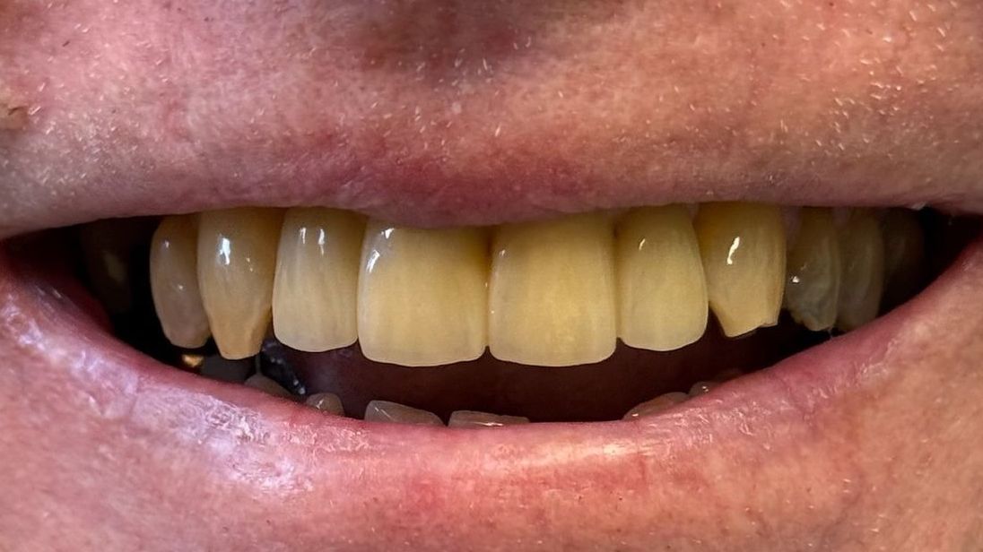 Close-up of a smiling mouth with yellowed teeth.