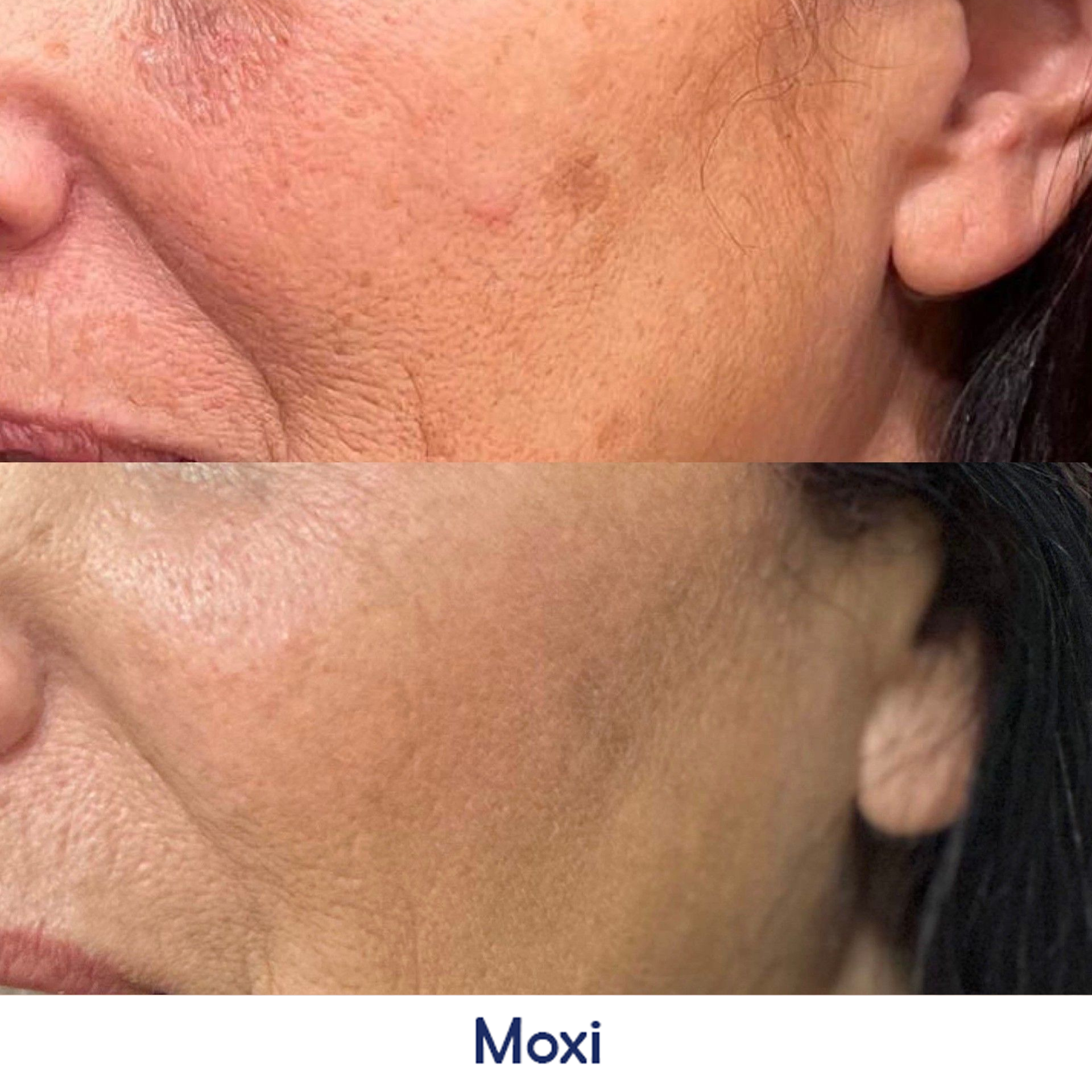 A before and after photo of a woman's face.