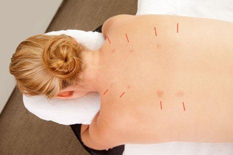 acupuncturist doctor smithtown ny