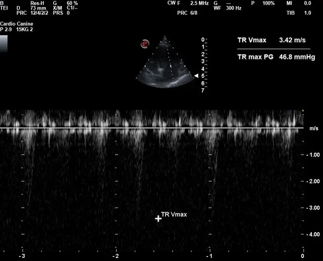 A black and white image of a heart that says tr vmax