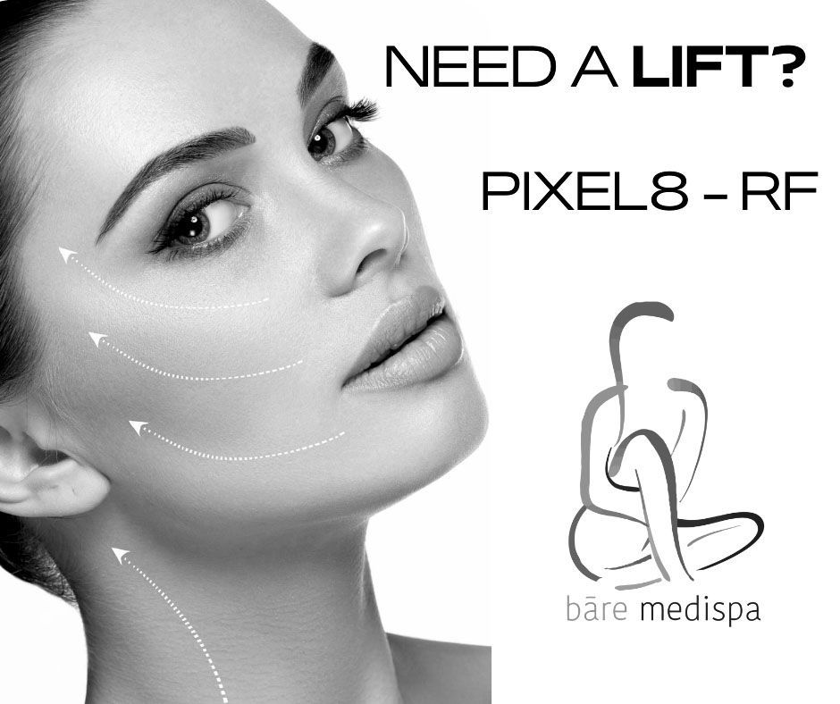 Pixel8-RF – Radiofrequency with microneedling