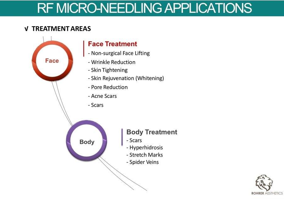 RF Microneedling Applications