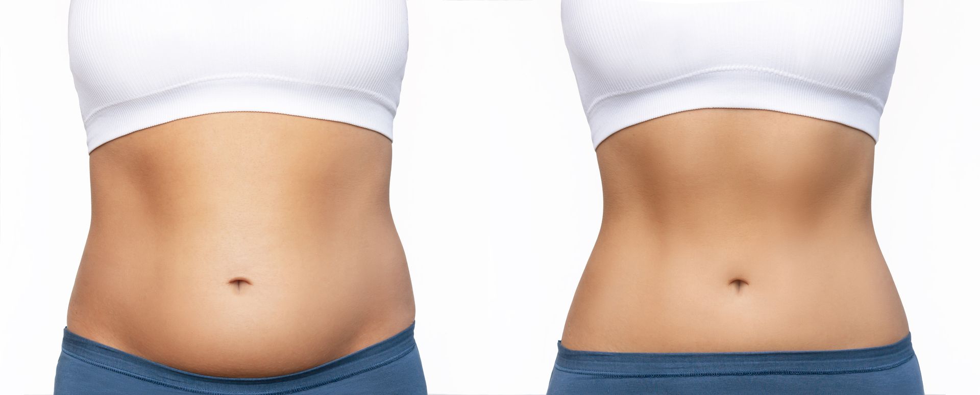 A before and after picture of a woman 's stomach