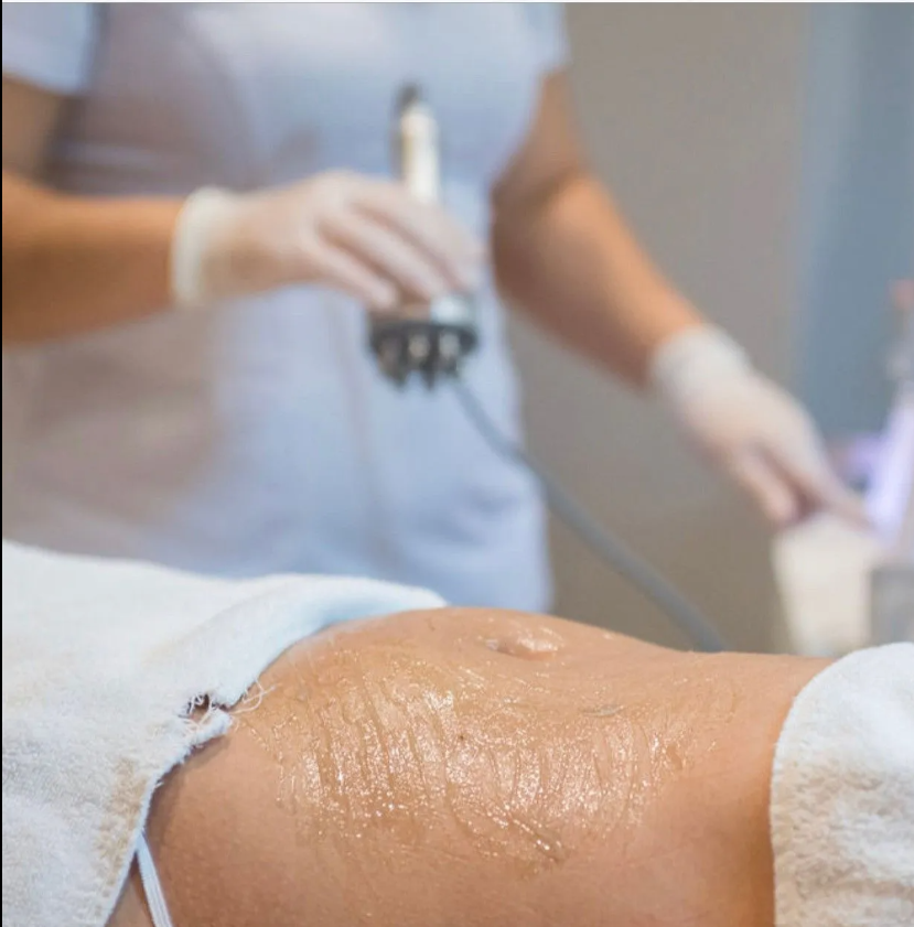 body contouring treatments