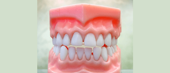 Teeth