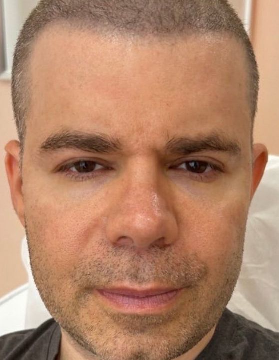 A close-up portrait of an individual with short hair, looking directly at the camera with a neutral expression.