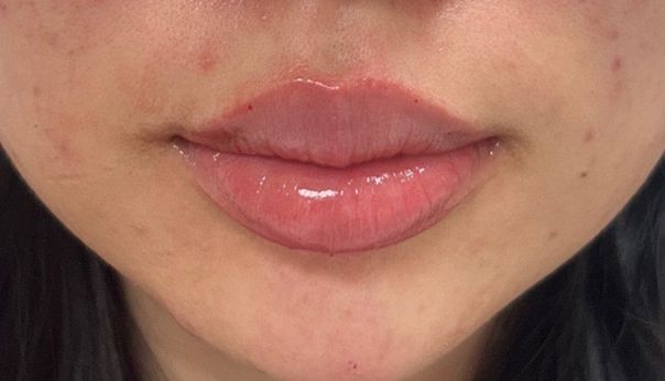 Close-up of a person's mouth with glossy, pinkish-toned lips and smooth skin.