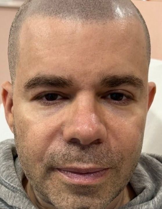 A close-up portrait of a person with a shaved head and light facial hair, looking directly at the camera.