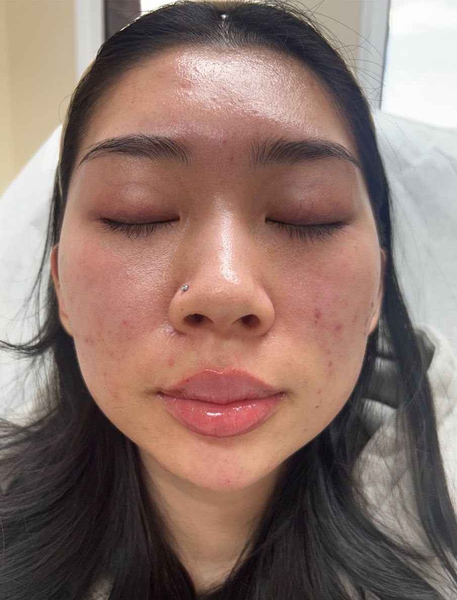 Close-up portrait of a person with eyes closed, showing facial skin texture and a small nose piercing.