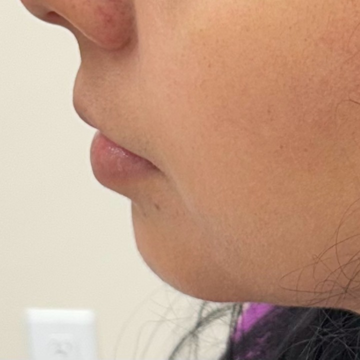Profile view of a person with a defined nose, lips, and jawline, looking slightly downward.