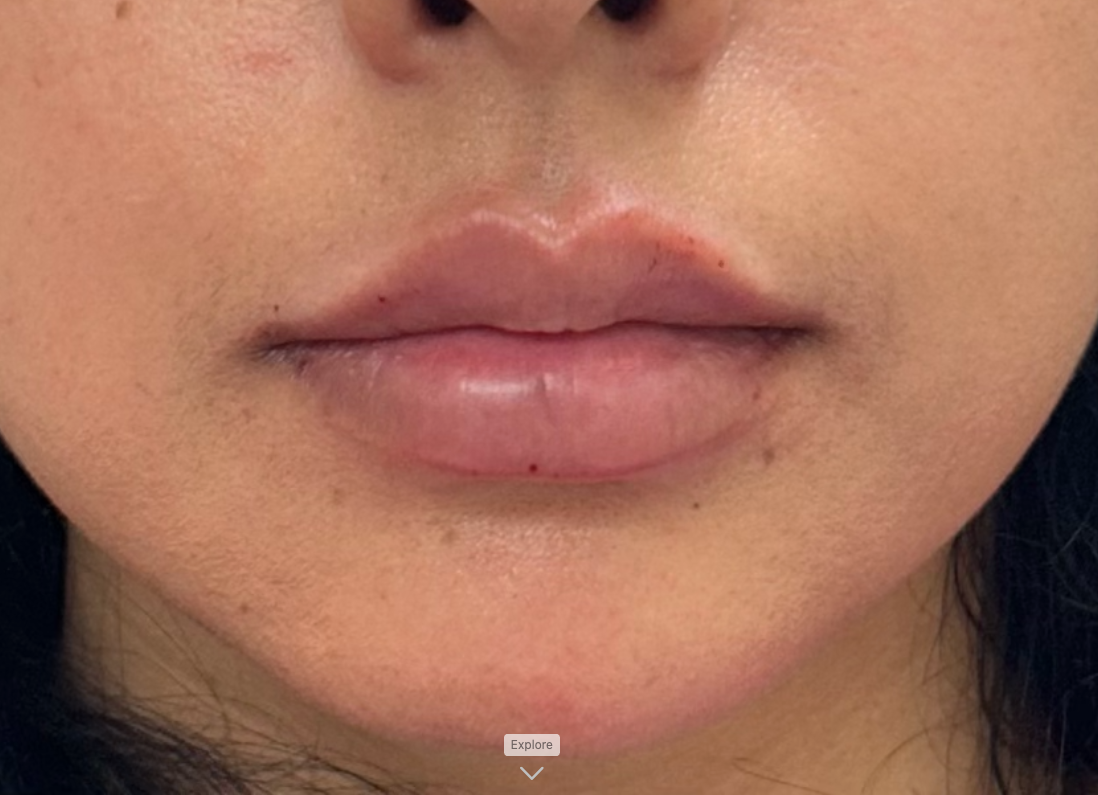 Close-up of a person's lips. The lips are full and slightly glossy, with a light pink hue.