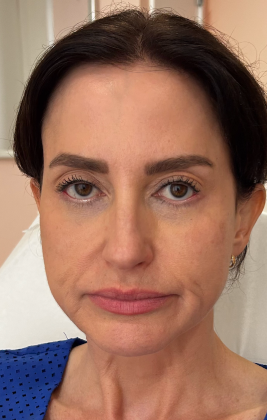 Woman with brown hair and eyes, slight wrinkles, looking directly at the camera, wearing a blue top.