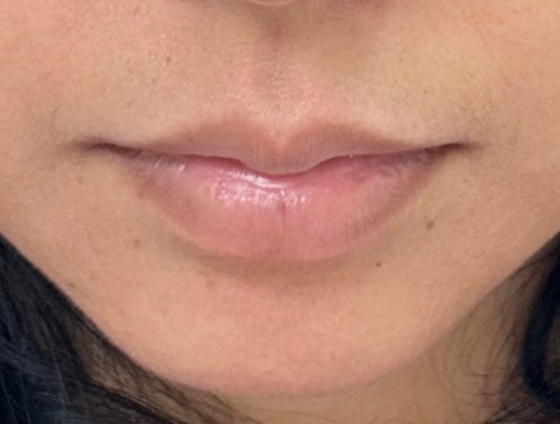 Close-up of a person's lips. The lips are full and slightly pink.