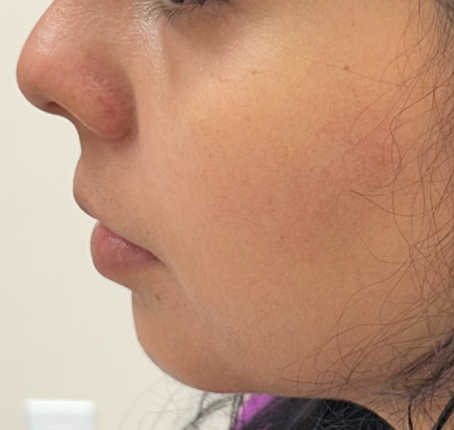 Profile view of a person with a defined nose, lips, and jawline, looking slightly downward.