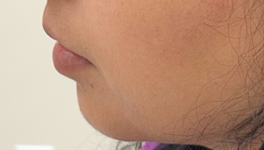 Profile view of a person with a defined nose, lips, and jawline, looking slightly downward.