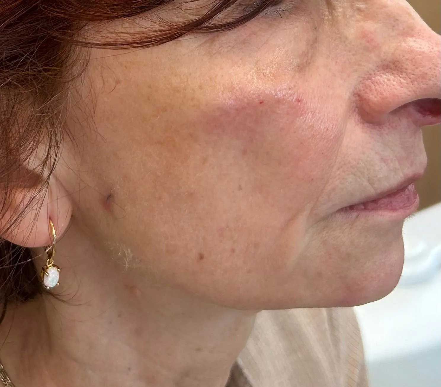 Woman's profile with reddish skin, age spots, and visible wrinkles, wearing a gold earring.