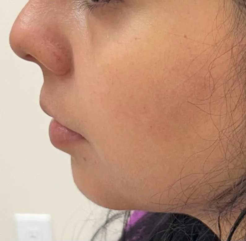 Profile view of a woman's face, showing her nose, lips, and jawline.