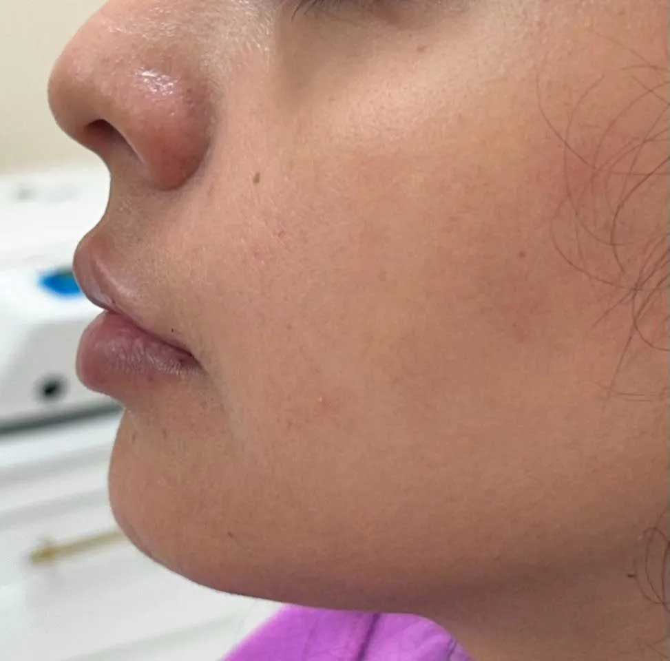 Profile view of a person with pale skin, slightly plump lips, and a small nose, facing left.