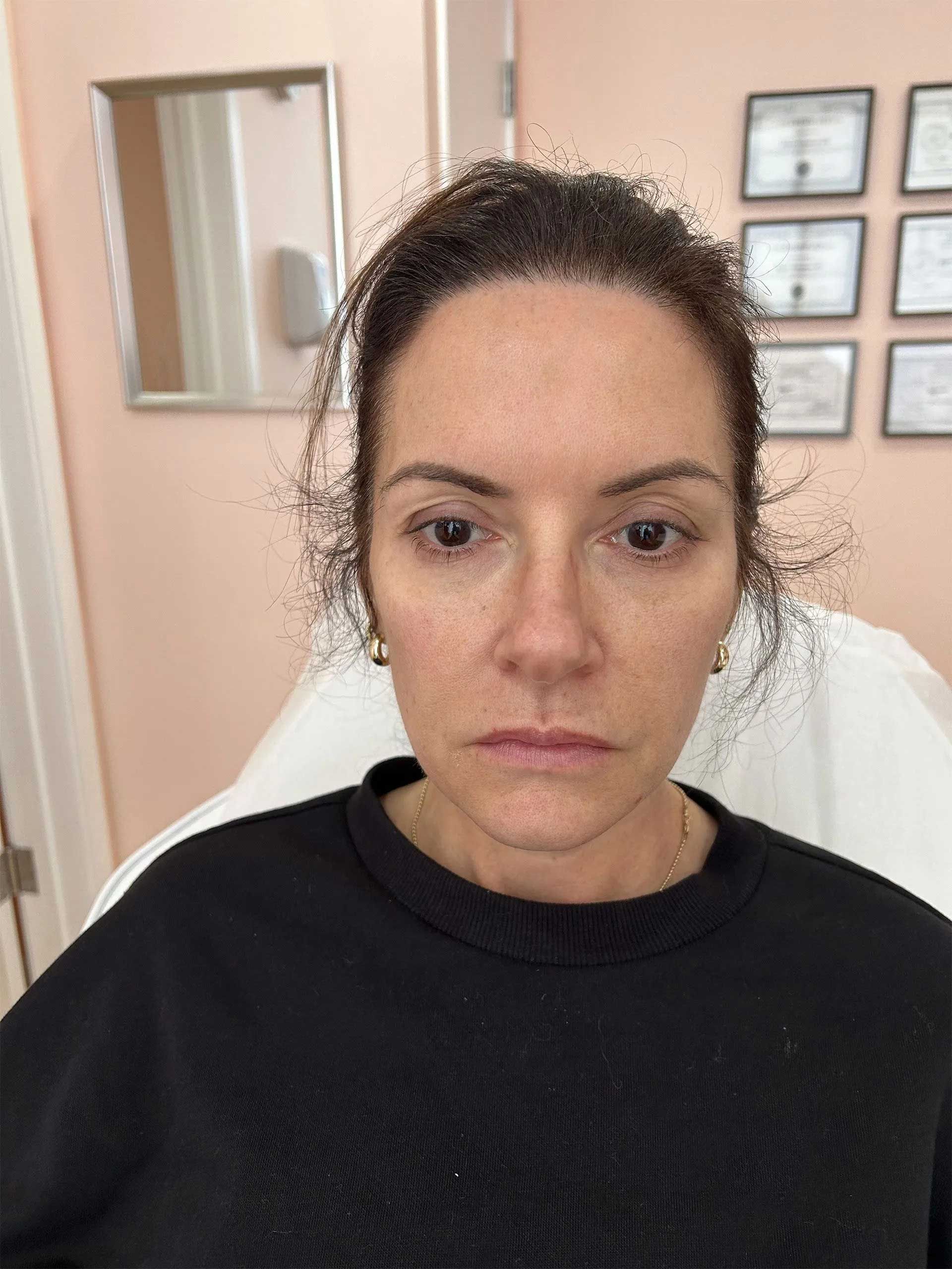 Woman with light skin, seated, in a medical office, looking at the camera, wearing a black shirt, and a neutral expression.