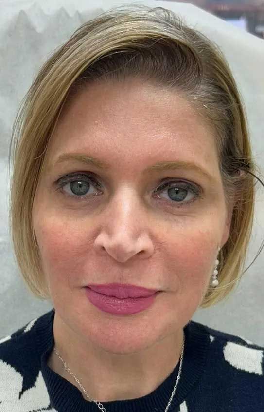 Woman with fair skin, short blonde hair, and pink lipstick, wearing a sweater, looking forward.