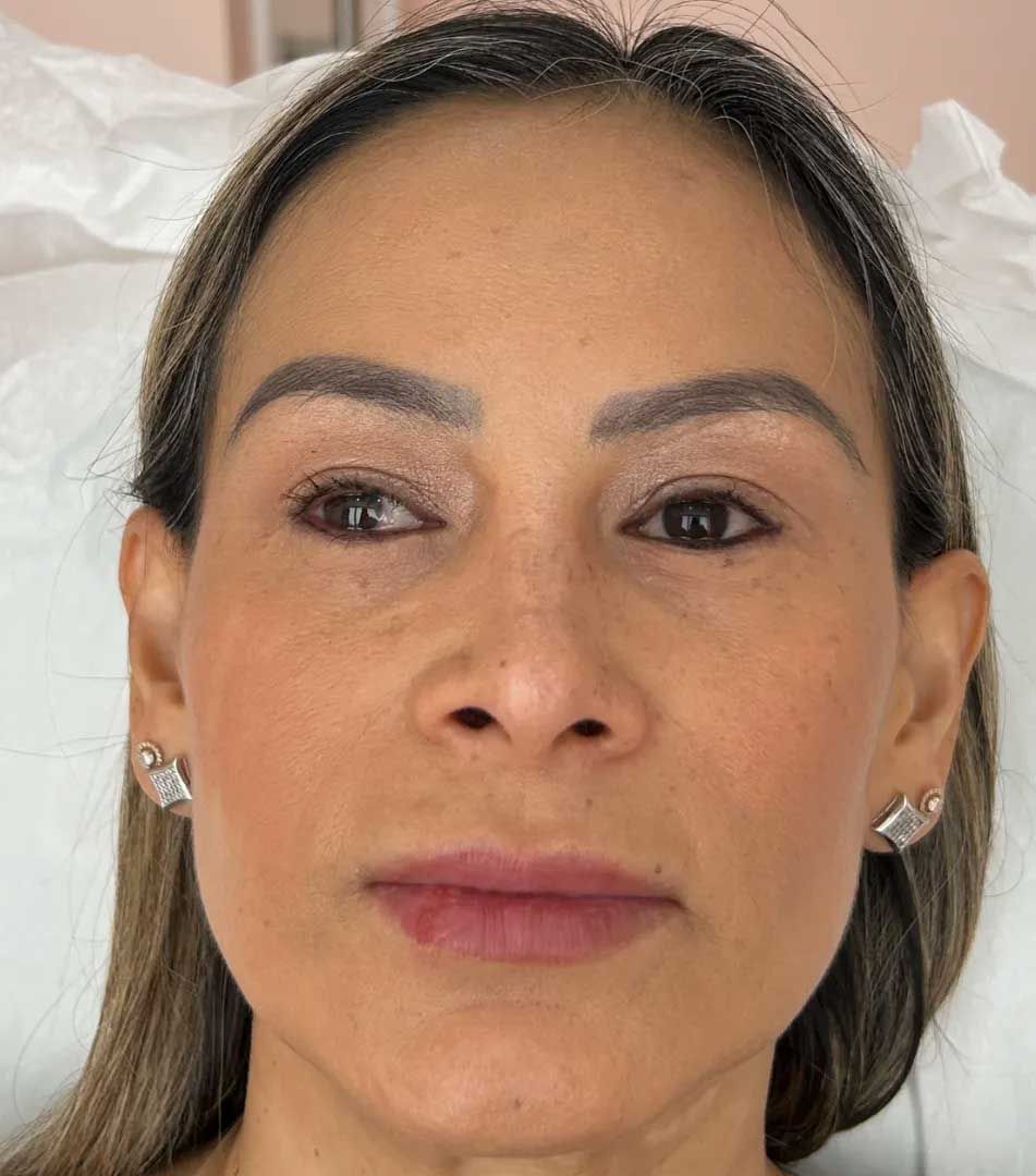 Woman with makeup, looking forward, light skin tone.