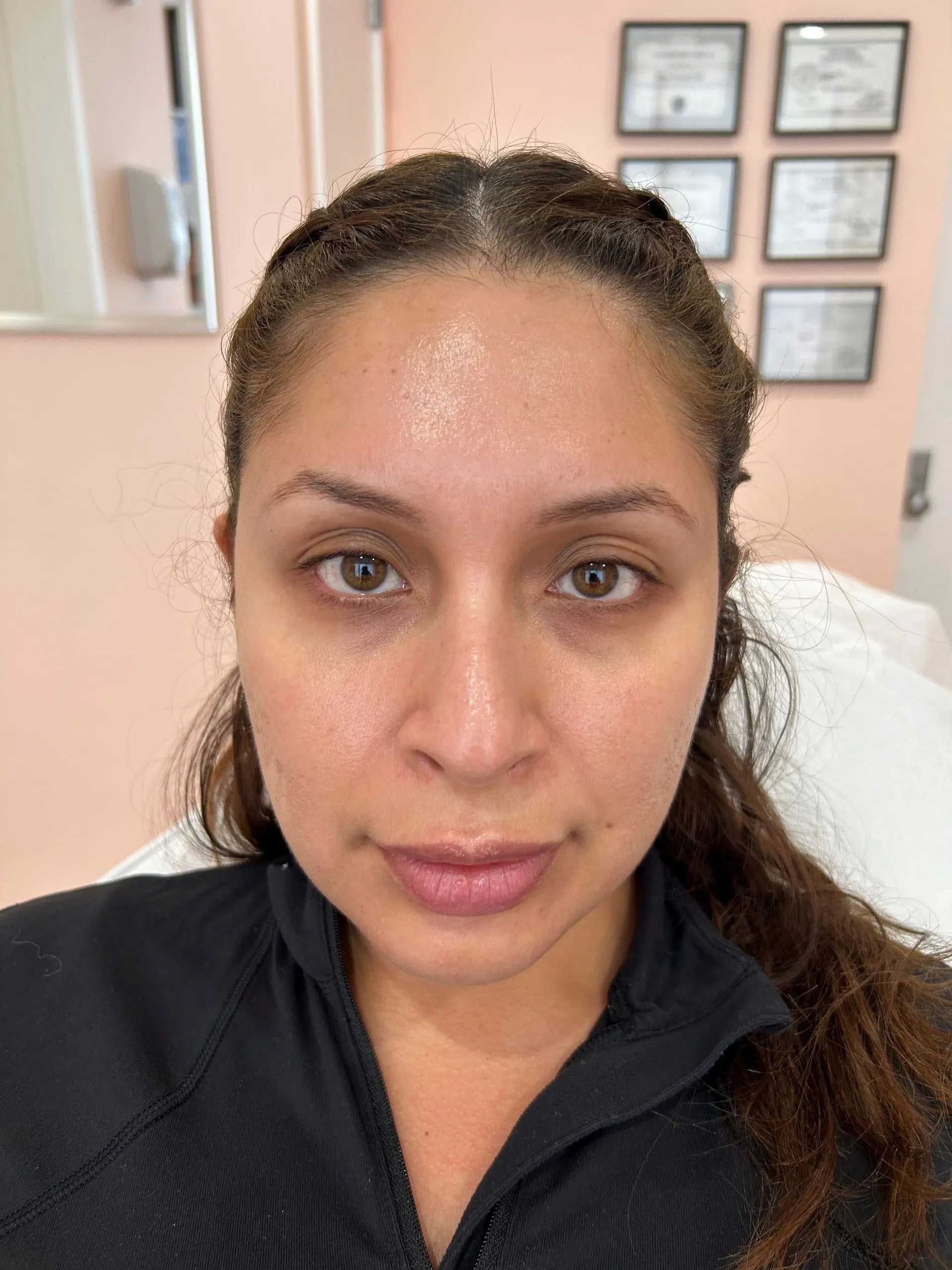 Woman with light brown hair, in a medical setting. She has brown eyes, and wears a black top.