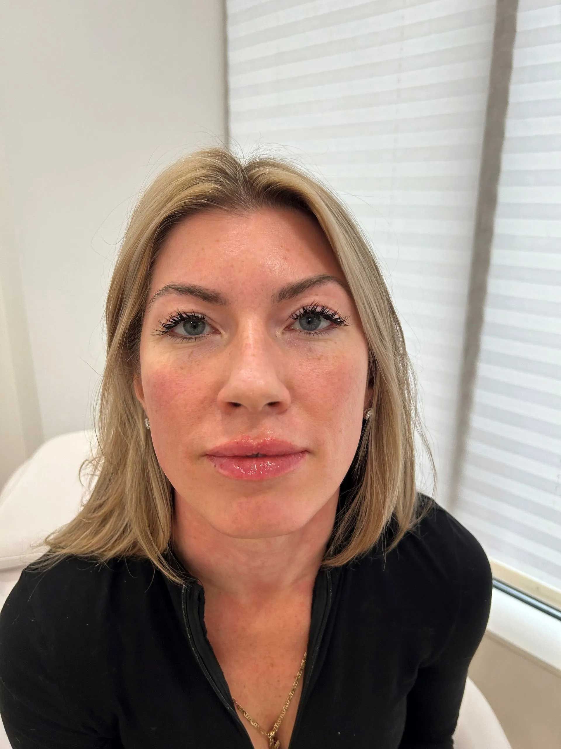 Woman with blonde hair and fair skin, looking at the camera. Wearing a black top, in a clinic-like setting.