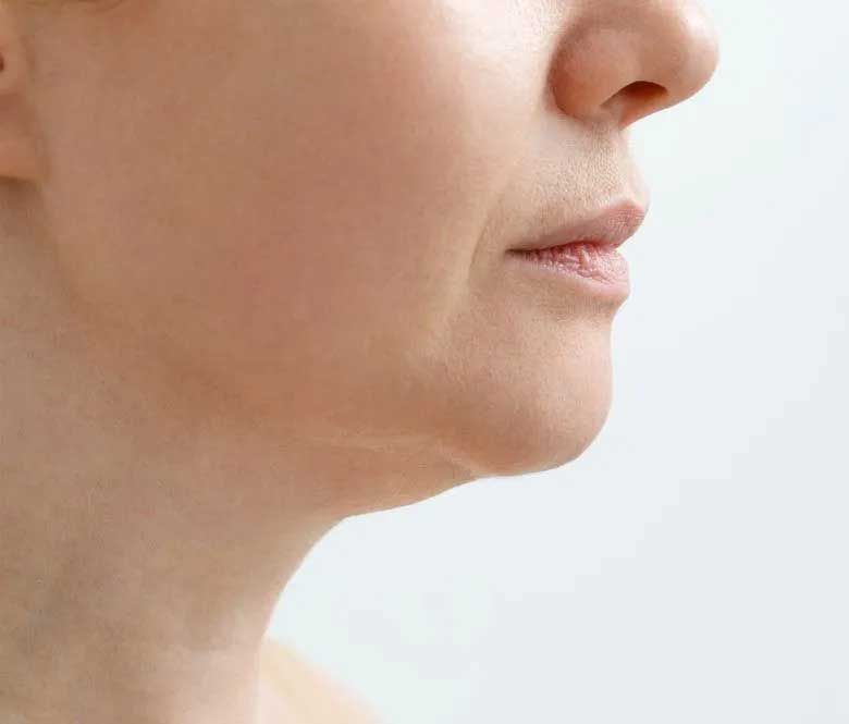 Profile of a woman with visible double chin and neck wrinkles, light skin, against a plain white background.