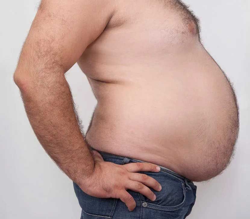 Man with a large protruding belly, wearing jeans, with hand on hip, turned to the side.