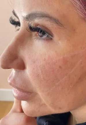 Woman's profile, showing skin texture and scars. Pink hair, long lashes, slightly parted lips.