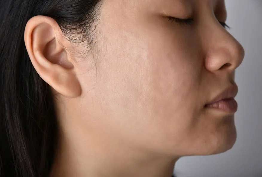 Side profile of a person with closed eyes, showing their ear, cheek, nose, and lips.