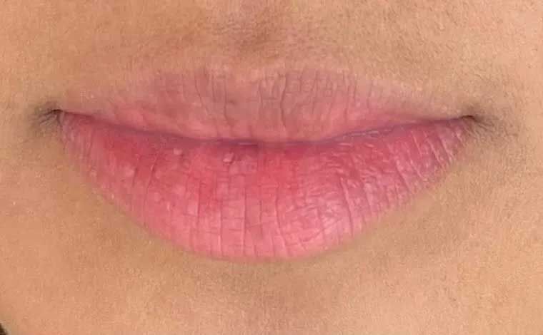 Close-up of a person's lips, with pink color and slight imperfections visible.