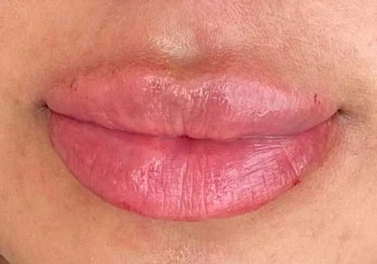 Close-up of full, plump lips with a slightly red tint, possibly after lip filler.